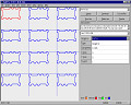 Dispensing System Functions